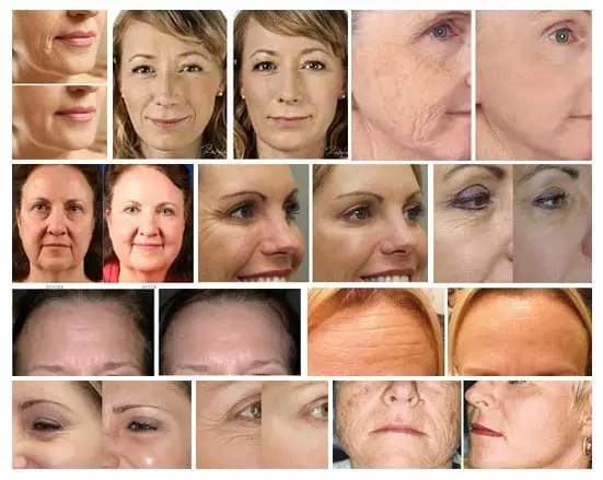 Treme Anti Wrinkle Cream 6